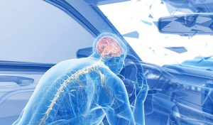 3 Essential Steps to Avoid Brain Injuries in Car Accidents